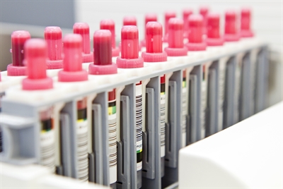 Beim Gesundheitsamt des Märkischen Kreises sind innerhalb eines Tages 1.378 Coronanachweise eingegangen. Foto: Labor Wahl/Märkischer Kreis